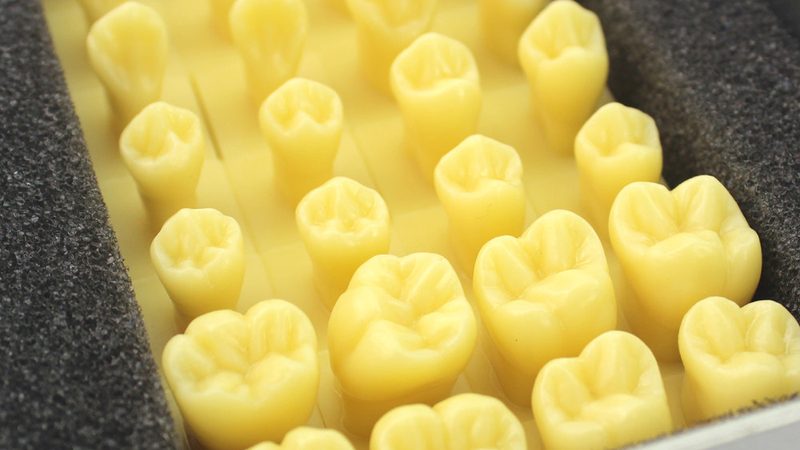牙周刮治，医保报销知多少？**